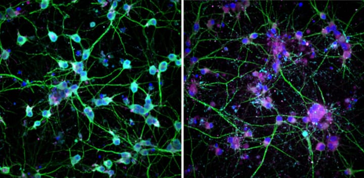 Creation of the World's First "Neuromap" by Utah-based Recursion Pharmaceuticals Triggers a $30 Million Payment from Roche and Genentech